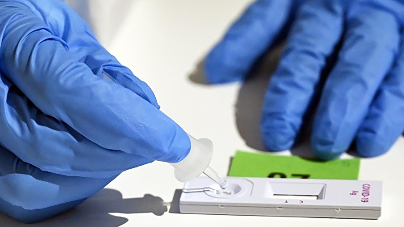 ZMOS žiada vládu o zavedenie systému do testovaní obyvateľstva