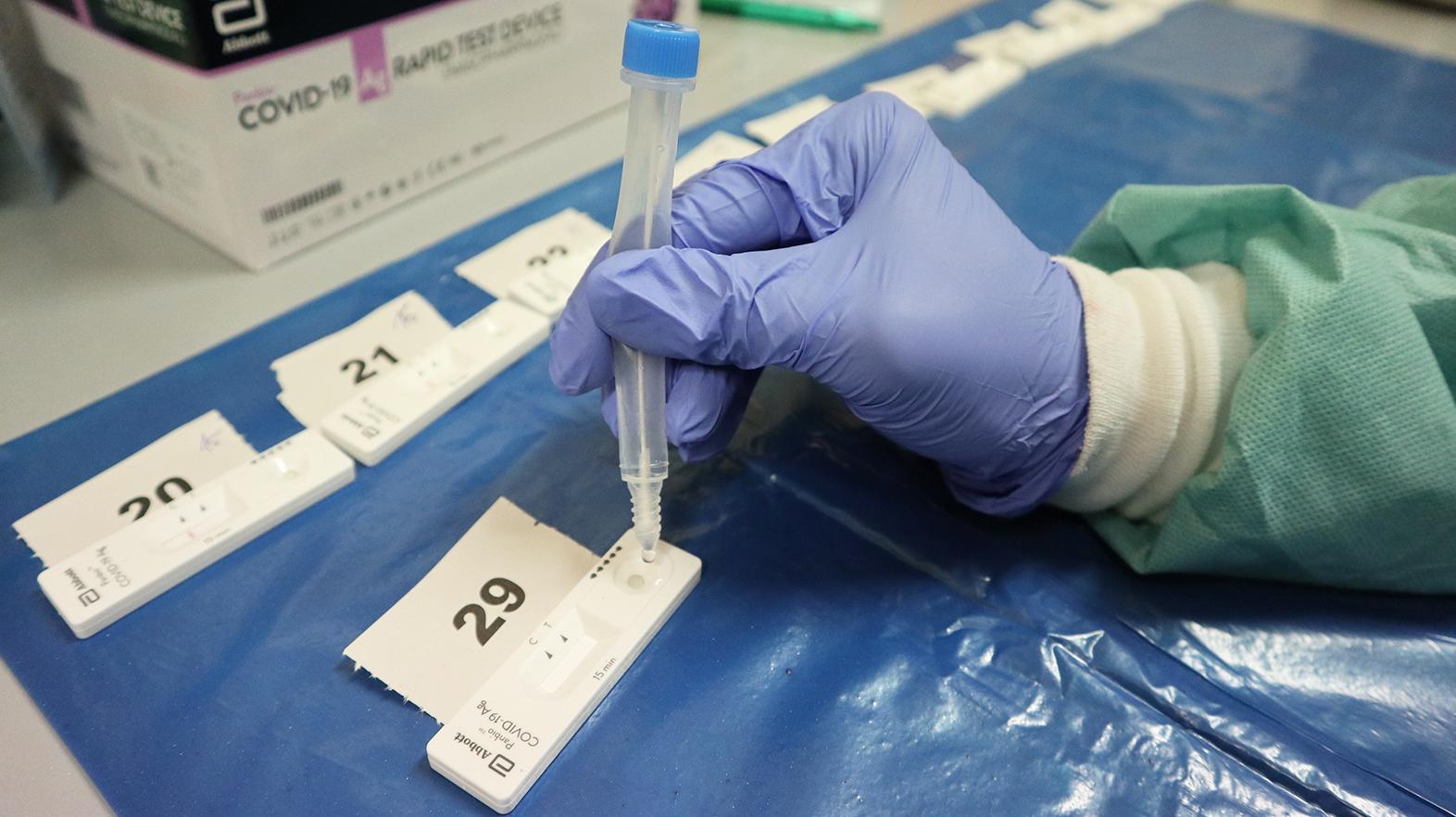 Antigénové testovanie pre samoplatcov v nemocnici už od stredy